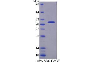 Image no. 1 for Transmembrane Protease, serine 2 (TMPRSS2) (AA 254-490) protein (His tag) (ABIN4989544)