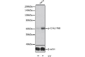 Western blot analysis of extracts of HeLa cells, using Phospho-Chk2-T68 antibody (ABIN6135202, ABIN6136046, ABIN6136047 and ABIN6225610). (CHEK2 antibody  (pThr68))