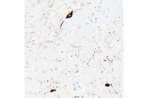 Immunohistochemistry of paraffin-embedded rat brain using Somatostatin (SST) Rabbit mAb (ABIN7270492) at dilution of 1:1000 (40x lens). (Somatostatin antibody  (AA 23-116))
