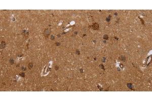 Immunohistochemistry of paraffin-embedded Human brain tissue using FMN2 Polyclonal Antibody at dilution 1:30 (Formin 2 antibody)