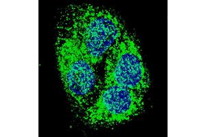 Fluorescent confocal image of HepG2 cells stained with BNIP3 (BH3 Domain Specific) antibody. (BNIP3 antibody  (AA 215-252))