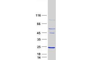 Validation with Western Blot (ARL5A Protein (Transcript Variant 1) (Myc-DYKDDDDK Tag))