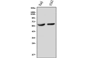 Western blot analysis of IL3RA using anti-IL3RA antibody (ABIN7599742).
