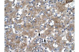 ZNF81 antibody was used for immunohistochemistry at a concentration of 4-8 ug/ml to stain Hepatocyte (arrows) in Human liver. (ZNF81 antibody  (Middle Region))