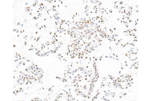 Immunocytochemistry (ICC) image for anti-Runt-Related Transcription Factor 2 (RUNX2) (AA 300-350) antibody (ABIN7795797) (Recombinant RUNX2 antibody  (AA 300-350))