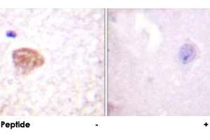 Immunohistochemical analysis of paraffin-embedded human brain tissue using DDX3X polyclonal antibody . (DDX3X antibody)