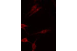 ABIN6275280 staining Hela by IF/ICC. (MT-ND1 antibody  (Internal Region))