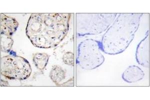 Immunohistochemistry analysis of paraffin-embedded human placenta tissue, using STEAP4 Antibody.