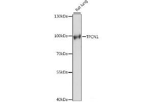 Western blot analysis of extracts of Rat lung using TPCN1 Polyclonal Antibody at dilution of 1:1000. (TPCN1 antibody)