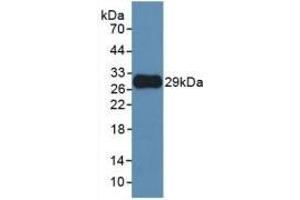 Detection of Recombinant MMP25, Human using Monoclonal Antibody to Matrix Metalloproteinase 25 (MMP25) (MMP25 antibody  (AA 108-313))