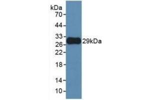 Detection of Recombinant MMP25, Human using Monoclonal Antibody to Matrix Metalloproteinase 25 (MMP25)