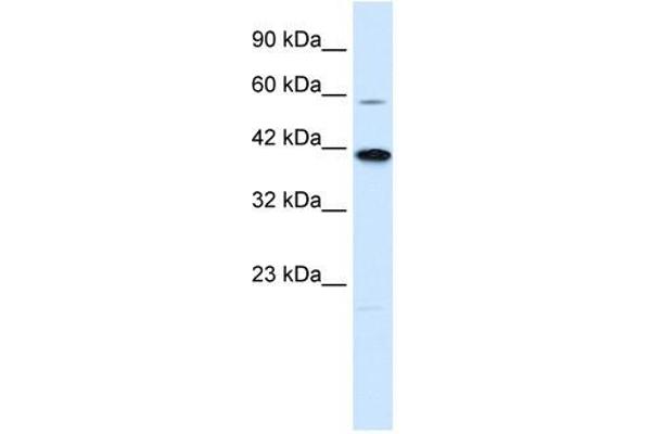 KCNK13 antibody  (C-Term)