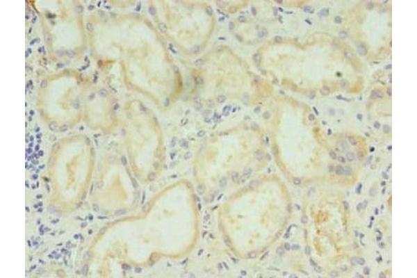 LYPLAL1 antibody  (AA 2-237)