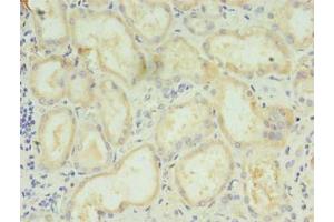 Immunohistochemistry of paraffin-embedded human kidney tissue using ABIN7158756 at dilution of 1:100 (LYPLAL1 antibody  (AA 2-237))