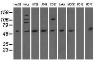 Image no. 4 for anti-5'-Nucleotidase Domain Containing 1 (NT5DC1) antibody (ABIN1499836)