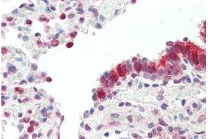 Human, Lung: Foramlin-Fixed Paraffin-Embedded  (FFPE) (MXD4 antibody  (N-Term))