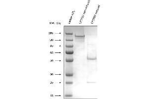 Expression of recombinant CR3022 antibody (SARS-CoV-2 antibody)