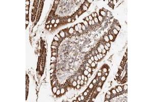 Immunohistochemical staining of human small intestine with ARHGEF10L polyclonal antibody  strong cytoplasmic positivity in glandular cells. (ARHGEF10L antibody)