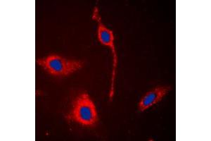 Immunofluorescent analysis of EPHA6 staining in A549 cells. (EPH Receptor A6 antibody  (C-Term))