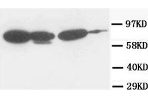 Western Blotting (WB) image for anti-Junction Plakoglobin (JUP) antibody (ABIN1107897)