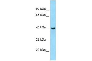 WB Suggested Anti-Qtrtd1 Antibody Titration: 1. (QTRTD1 antibody  (C-Term))