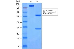 SDS-PAGE Analysis Purified Cytokeratin 8/18 Mouse Monoclonal Antibody (rKRT8. (Recombinant KRT8, KRT18 antibody)