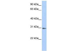 UTY antibody used at 1 ug/ml to detect target protein. (UTY antibody  (Middle Region))