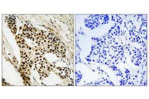 Immunohistochemistry (IHC) image for anti-Mitogen-Activated Protein Kinase-Activated Protein Kinase 2 (MAPKAPK2) (Ser272) antibody (ABIN1848344) (MAPKAP Kinase 2 antibody  (Ser272))