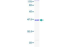 SKP1 Protein (AA 1-160) (GST tag)