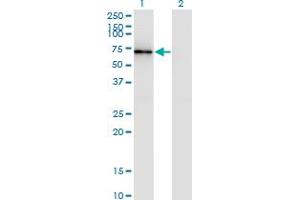 Western Blot analysis of CTTN expression in transfected 293T cell line by CTTN monoclonal antibody (M01), clone 2B5. (Cortactin antibody  (AA 341-450))