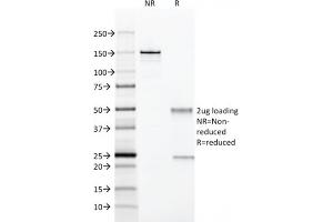 SDS-PAGE Analysis Purified CD28 Mouse Monoclonal Antibody (204.