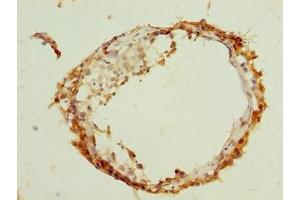 Immunohistochemistry of paraffin-embedded human testis tissue using ABIN7144623 at dilution of 1:100 (ARMCX2 antibody  (AA 161-460))