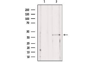 Western blot analysis of extracts from mouse brain, using SSTR2  Antibody. (SSTR2 antibody  (C-Term))