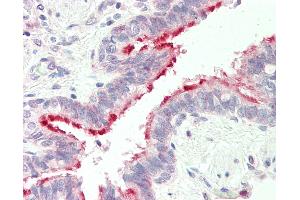 Human, Lung: Formalin-Fixed Paraffin-Embedded (FFPE). (ALDH3B1 antibody  (N-Term))