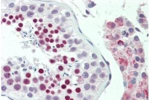 Human Testis: Formalin-Fixed, Paraffin-Embedded (FFPE) (ZFP91 antibody  (AA 216-245))