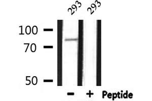 Western blot analysis of extracts from 293, using CDH3 Antibody. (P-Cadherin antibody  (N-Term))