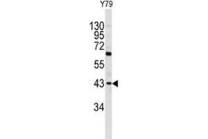 Western blot analysis of PRELP antibody (C-term) in Y79 cell line lysates (35ug/lane).