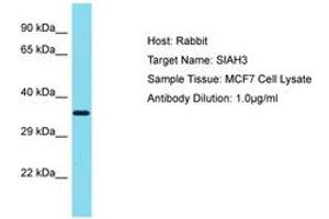 Image no. 1 for anti-Siah E3 Ubiquitin Protein Ligase Family Member 3 (SIAH3) (AA 151-200) antibody (ABIN6750786) (SIAH3 antibody  (AA 151-200))