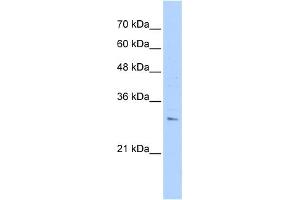 WB Suggested Anti-RHBDL2 Antibody Titration:  0. (RHBDL2 antibody  (N-Term))
