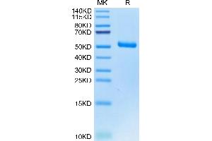 Human EVA-1 on Tris-Bis PAGE under reduced condition. (MPZL2 Protein (AA 27-154) (Fc Tag))