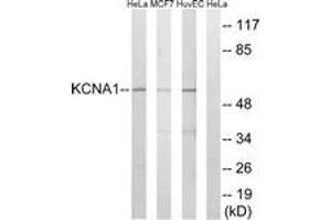 Western blot analysis of extracts from HuvEc/MCF-7/HeLa cells, using KCNA1 Antibody. (KCNA1 antibody  (AA 256-305))