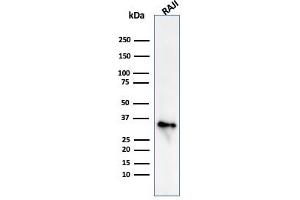 Western Blot Analysis of Raji cell lysate using CD74 Mouse Monoclonal Antibody (CLIP/813) (CD74 antibody)
