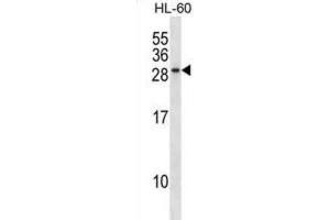 Western Blotting (WB) image for anti-RAB15, Member RAS Onocogene Family (RAB15) antibody (ABIN2998980) (RAB15 antibody)