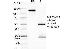 SDS-PAGE Analysis Purified PD1 (CD279) Monoclonal Antibody (NAT105). (PD-1 antibody)