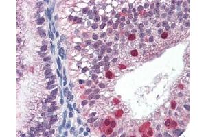 IHC testing of FFPE human uterus tissue with FANCG antibody at 3ug/ml. (FANCG antibody)