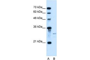 WB Suggested Anti-SHH Antibody Titration:  0. (Sonic Hedgehog antibody  (N-Term))