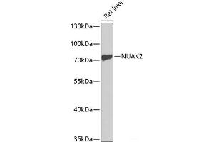 Western blot analysis of extracts of Rat liver using NUAK2 Polyclonal Antibody at dilution of 1:1000. (NUAK2 antibody)