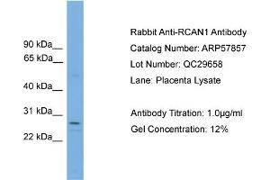 WB Suggested Anti-RCAN1  Antibody Titration: 0. (RCAN1 antibody  (N-Term))