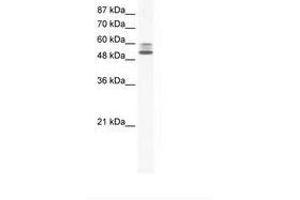 Image no. 1 for anti-Lysine (K)-Specific Demethylase 4D (KDM4D) (AA 434-483) antibody (ABIN202713) (JMJD2D antibody  (AA 434-483))