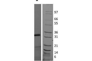 SDS-PAGE of Human Interleukin-17E (IL-25) Recombinant Protein SDS-PAGE of Human Interleukin-17E (IL-25) Recombinant Protein. (IL-25 Protein)